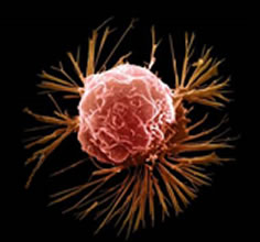 False-color SEM of breast cancer cell