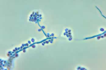 Sporotrichosis-causing fungus S. schenckii