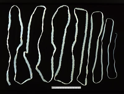 Beef tapeworm