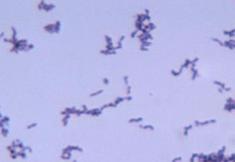 Acne causing Propionibacterium acnes bacteria.