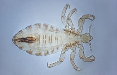 Body louse