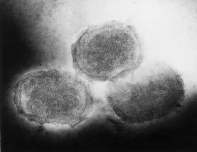 Molluscum poxvirus