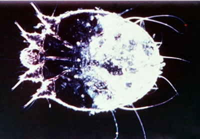 Sarcoptes scabiei, the mite that transmit scabies.